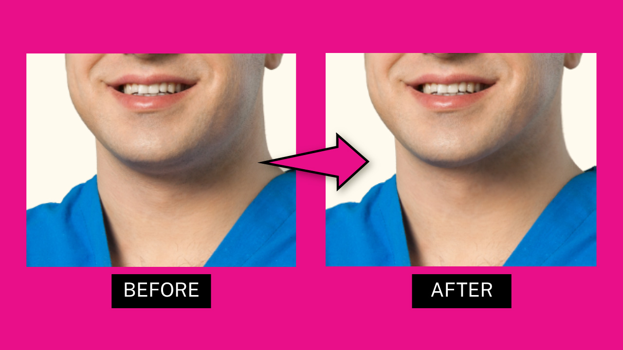 How to Get Rid of a Double Chin in Photos Using Photoshop The Result